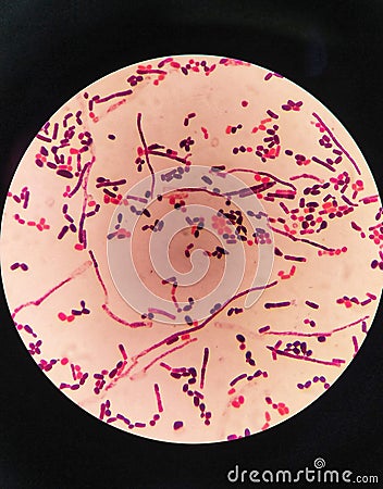 yeast cells and hyphae in gram stain fine with microscope. Stock Photo