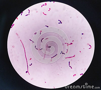 yeast cells and hyphae in gram stain fine with microscope. Stock Photo