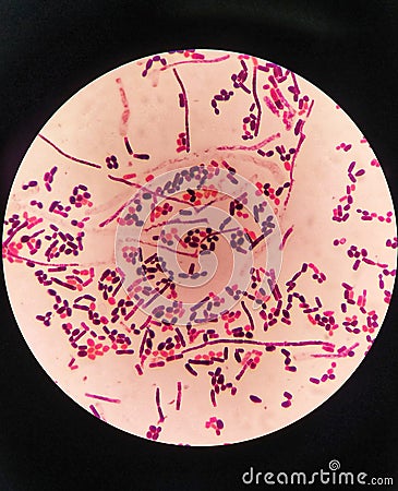 yeast cells and hyphae in gram stain fine with microscope. Stock Photo