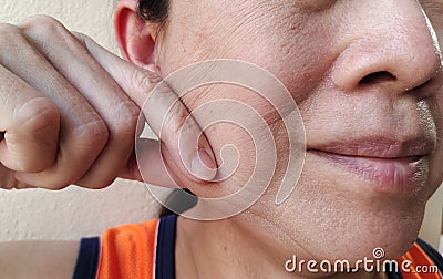 The flabbiness and wrinkles, dark spots and blemish on the face of the woman's Stock Photo