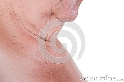 Flabby skin on the neck of an elderly woman isolated on white background Stock Photo