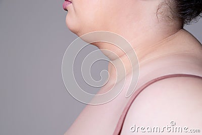 Flabby skin on the neck of an fat woman, female double chin on gray background Stock Photo