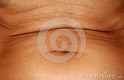 Flabby wrinkled abdomen. The navel is stretched. Stock Photo