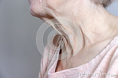 A flabby wrinkled excess skin on the neck of a senior woman close up Stock Photo
