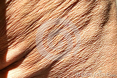 Flabby wrinkled skin on the human body Stock Photo