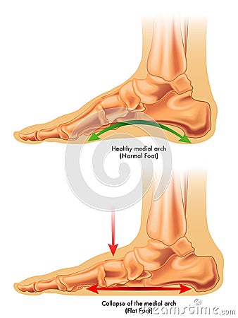 Flat foot Vector Illustration