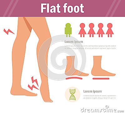 Flat foot. Vector. Cartoon. Vector Illustration