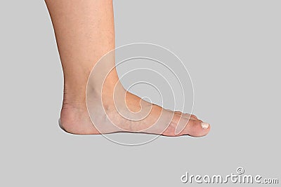 Flat foot of woman showing missing arch which can cause misalignment and orthopedic problems on white background Stock Photo