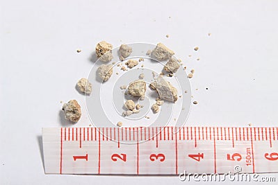 Flat lay or top view very small kidney stones with ruler at white background Stock Photo