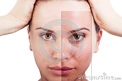 Flawless woman portrait before and after facial correction Stock Photo