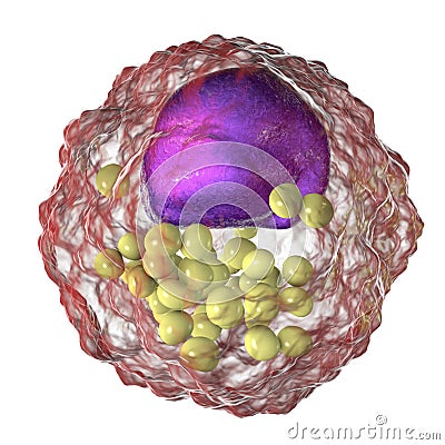 Foam cell, macrophage cells that contain lipid droplets Cartoon Illustration