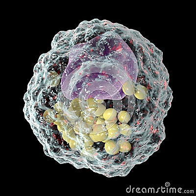 Foam cell, a macrophage cell with lipid droplets Cartoon Illustration