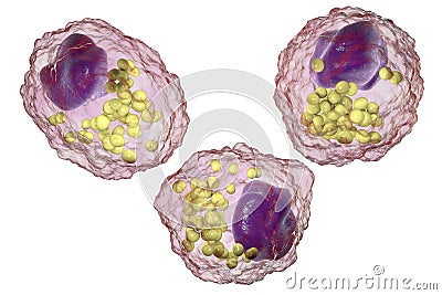 Foam cell, a macrophage cell with lipid droplets Cartoon Illustration