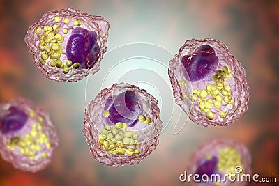 Foam cell, a macrophage cell with lipid droplets Cartoon Illustration