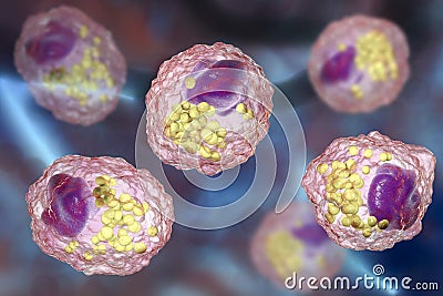 Foam cell, a macrophage cell with lipid droplets Cartoon Illustration