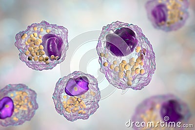 Foam cell, a macrophage cell with lipid droplets Cartoon Illustration