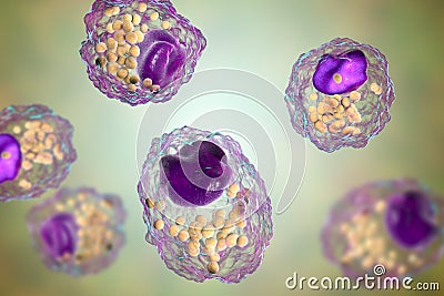 Foam cell, a macrophage cell with lipid droplets Cartoon Illustration