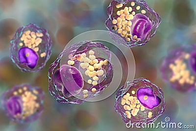 Foam cell, a macrophage cell with lipid droplets Cartoon Illustration