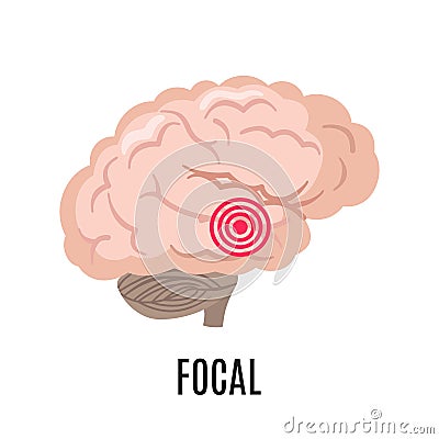 Focal epilepsy icon isolated on white background Vector Illustration