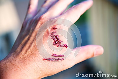 Focus dog bite wound and blood on hand. Infection and Rabies concept. Stock Photo