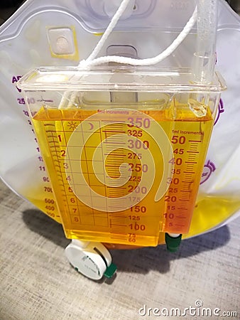 Foley catheter reservoir filled with yellow urine Stock Photo