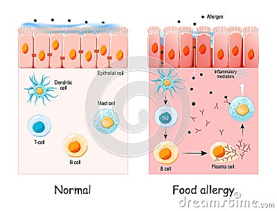 Food allergy. development of an allergic reaction Vector Illustration