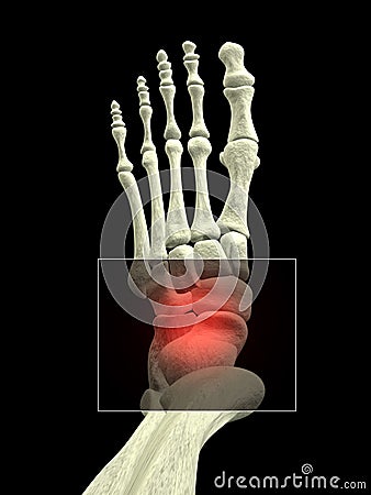 Foot with Ankle Pain Stock Photo