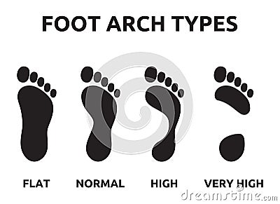 Foot arch types Vector Illustration