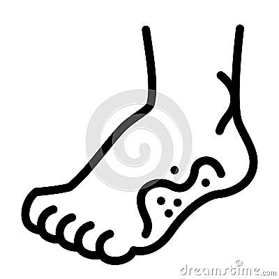 Foot frostbite icon, outline style Vector Illustration