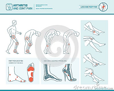 Foot pain and arthritis infographic Vector Illustration