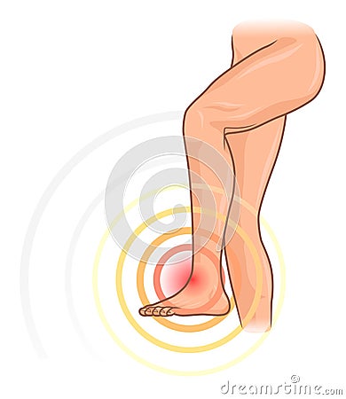 Foot pain Vector Illustration