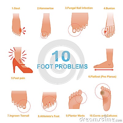 Foot Problems Vector Illustration