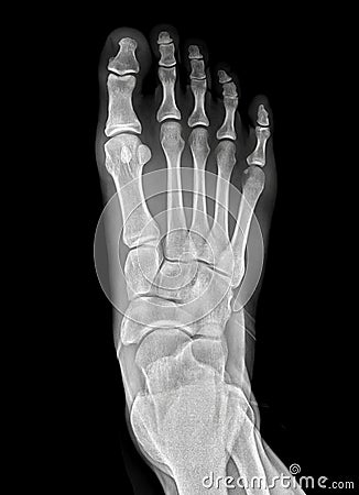 foot scan, film foot, foot pain, anatomy, ankle, arthritis, body, bone, bottom, broken, care, clinic, deformity, diagnosis, Stock Photo