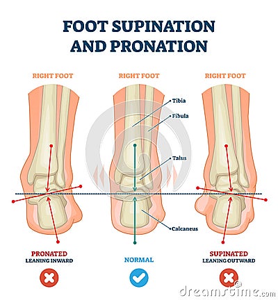 Foot supination and pronation vector illustration. Labeled medical scheme. Vector Illustration