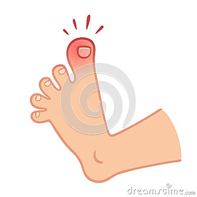 Foot with toe pain Vector Illustration