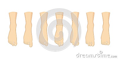 Foot toe shape types set. Vector Illustration