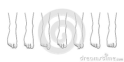 Foot toe shape types set. Vector Illustration