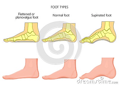 Foot types Vector Illustration