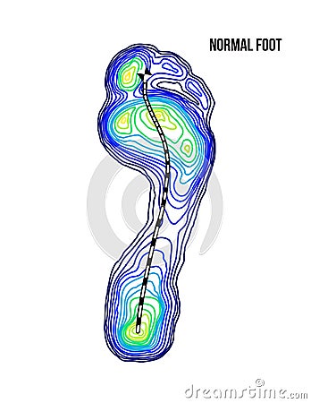 Foot weight distribution. Normal arch foot bottom thermal view. No deformation. Vector Illustration