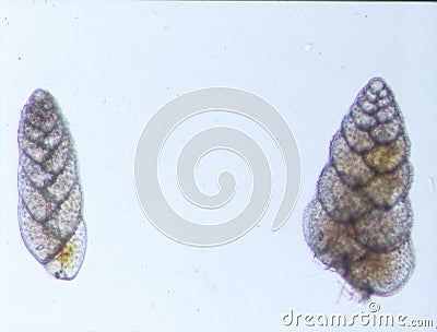 Foraminifera microorganisms from the sea Stock Photo