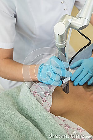 Fractional laser rejuvenation Stock Photo