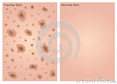 Freckle skin texture graphic Vector Illustration