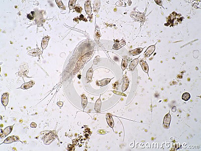 Freshwater aquatic plankton Stock Photo