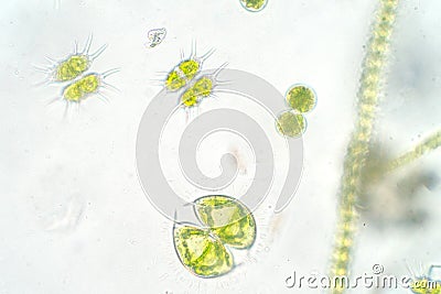 Freshwater aquatic plankton under microscope view Stock Photo