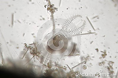 Freshwater rotifer or rotatoria Stephanoceros fimbriatus among phytoplankton Stock Photo