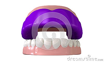 Gum Guard Fitted On Open False Teeth Stock Photo