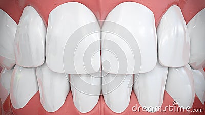 Frontal view on sparkling white anterior teeth Stock Photo