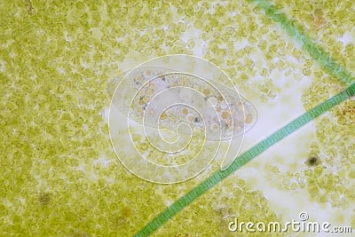 Frontonia sp. unicellular ciliate protists under the microscope. Stock Photo