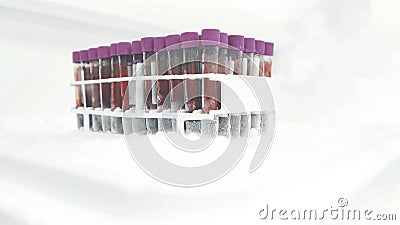 Frozen blood tubes samples stored in the laboratory refrigerator Stock Photo