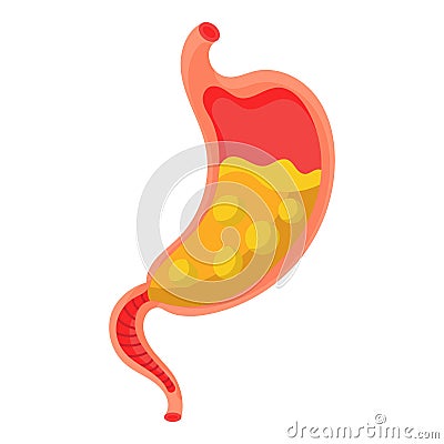 Full stomach. Heaviness of stomach, bloating, pain in the alimentary tract and acid heartburn. Duodenal problems and human organ Vector Illustration